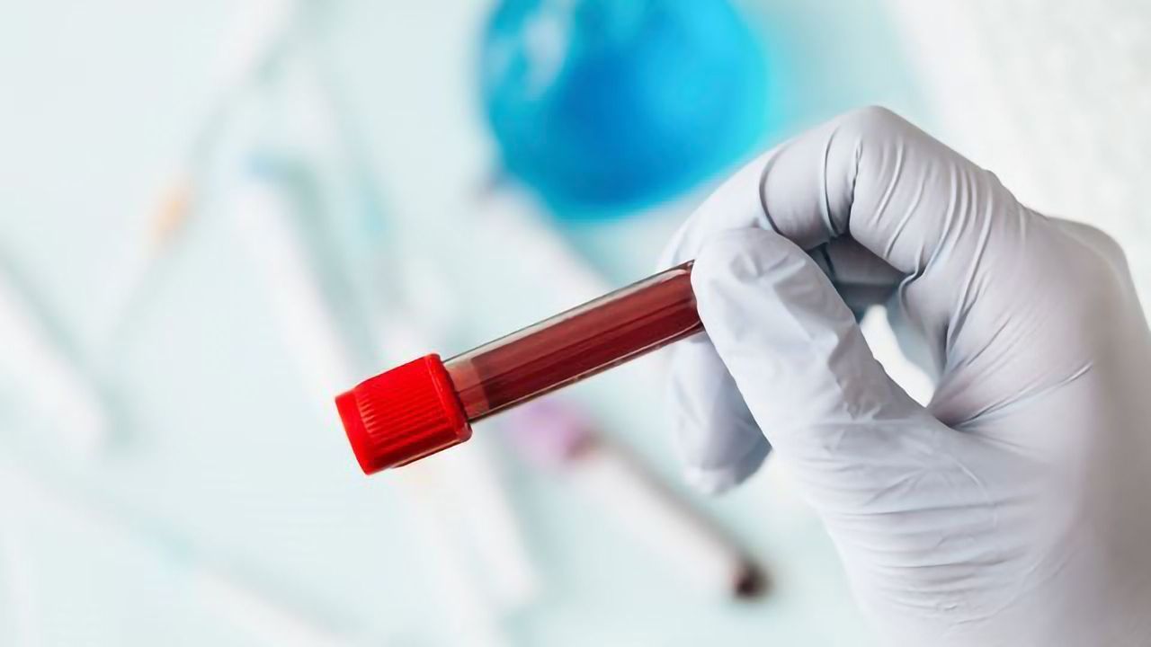 Higher End of Normal Blood Platelet Count Could Indicate Cancer
