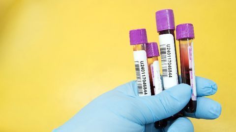 Phosphoprotein Biomarkers That Could Help To Guide Cancer Therapy Have Been Identified