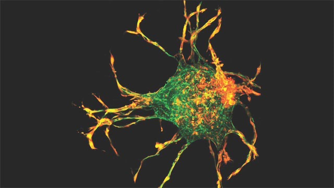 Studying Fibroblast Morphology