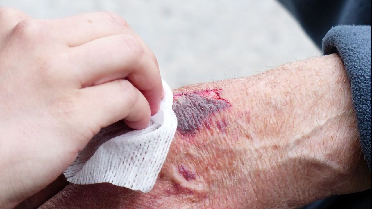 Researchers Uncover How Cells Interact With Supporting Proteins To Heal Wounds