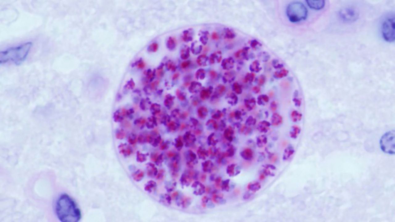 Two Billion People Have a Brain Parasite – Here's Why Many Haven't Noticed