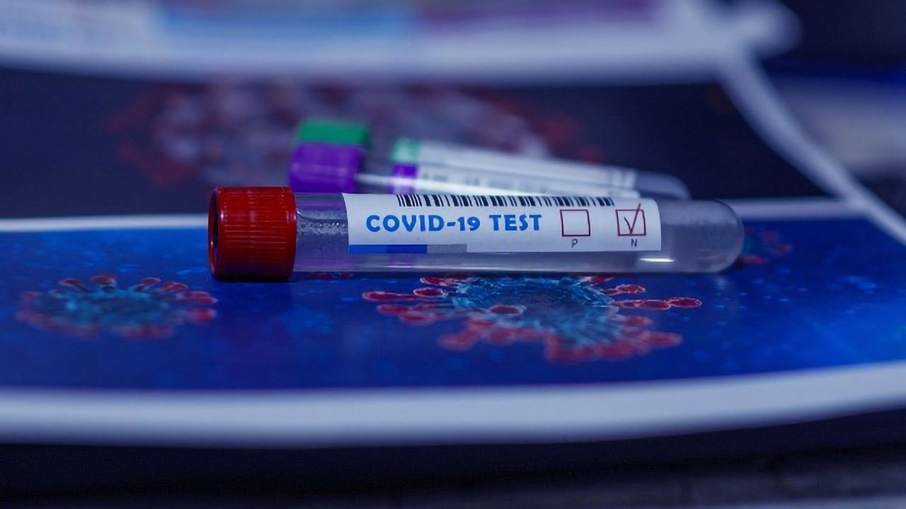 Streamlined Approach to COVID-19 Testing Can Avoid Potential Bottleneck