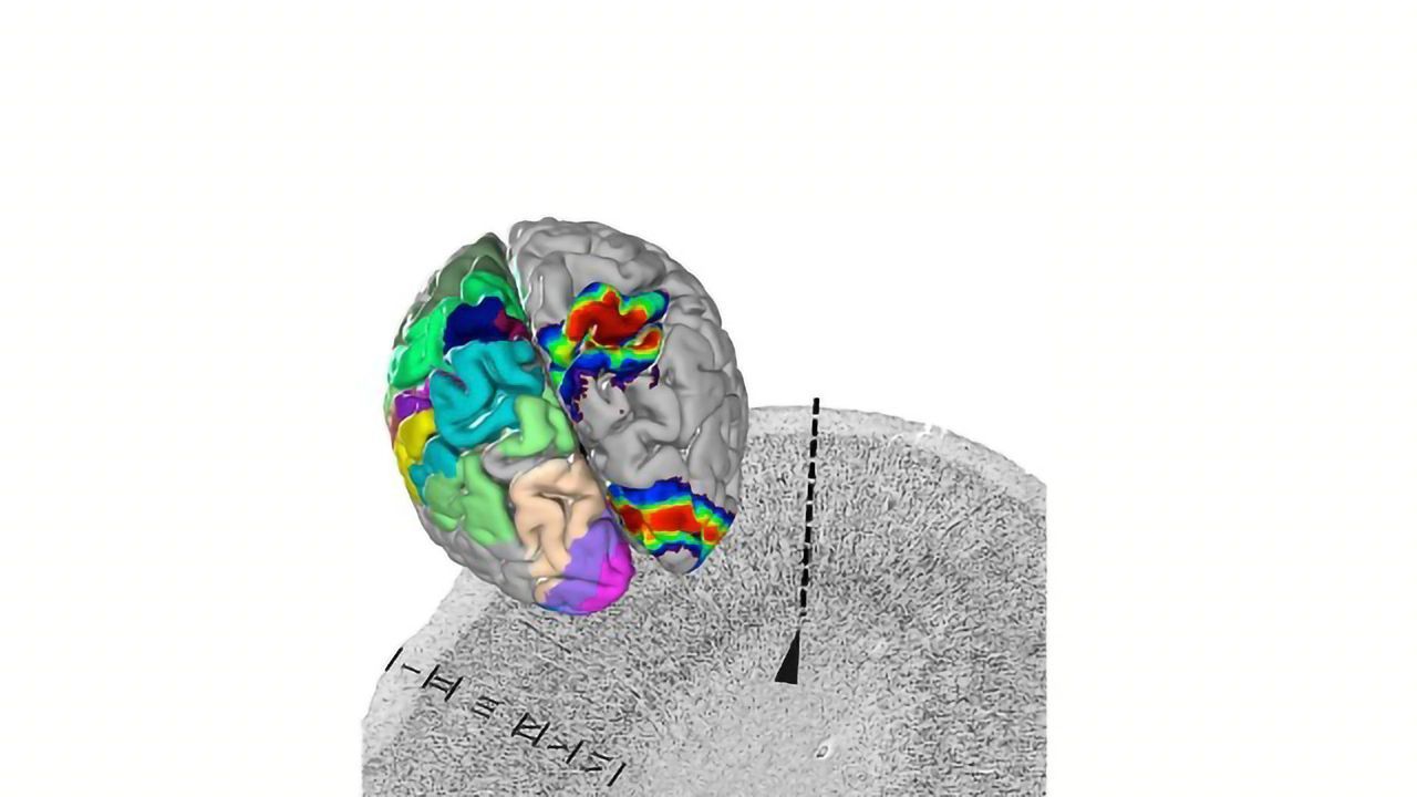 Изменчивость структур мозга. Bridge Brain Atlas. Человеческий мозг в Ховрино.