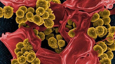 Staphylococcus Reveals a Weakness