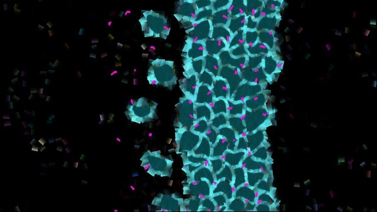 Mouse Study Shows Fragile X Neurons Lack Signal-Detecting "Antennas"
