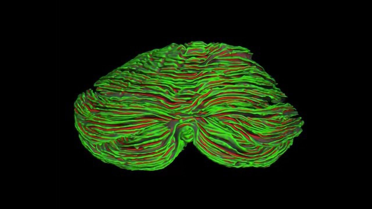 The Unfolded Cerebellum Is Three Feet Long