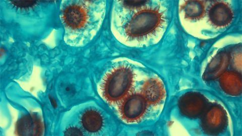 Truffle Spores Truffle Spores