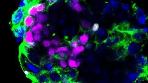 Embryos Could Be Susceptible to Coronavirus, Study Suggests
