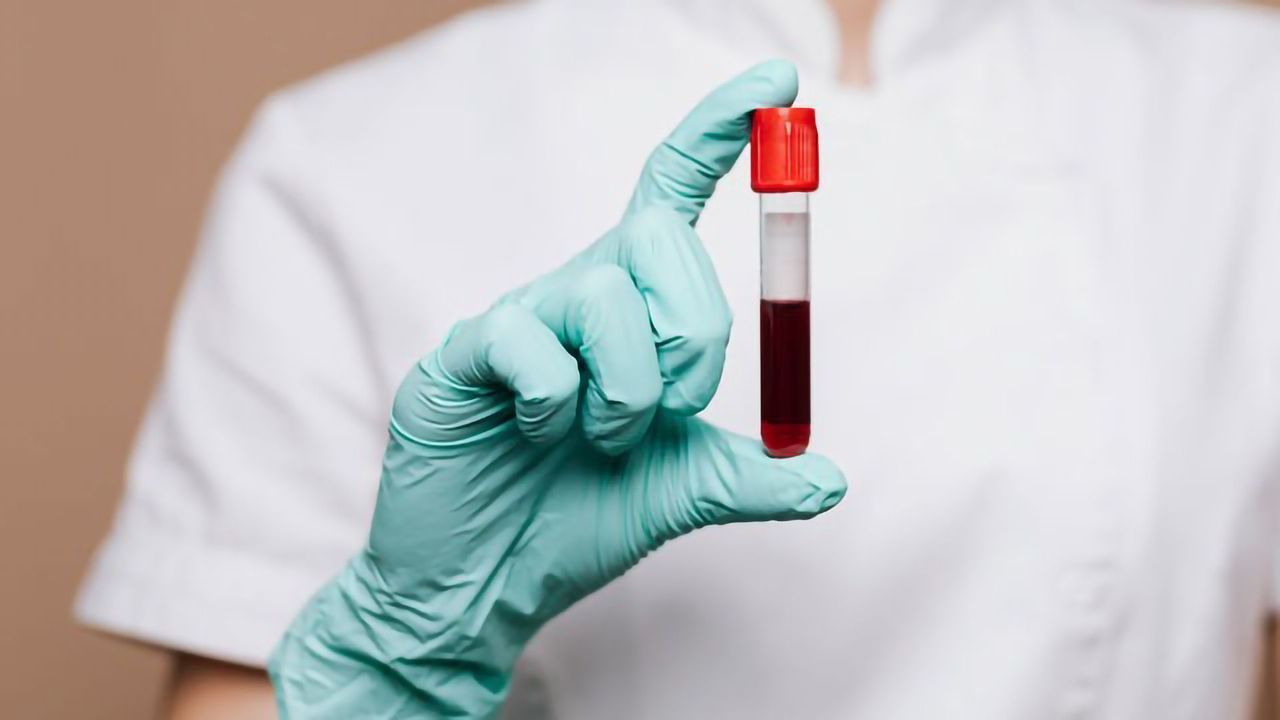 Simpler, High-Accuracy Method Detects Rare Circulating Tumor Cells