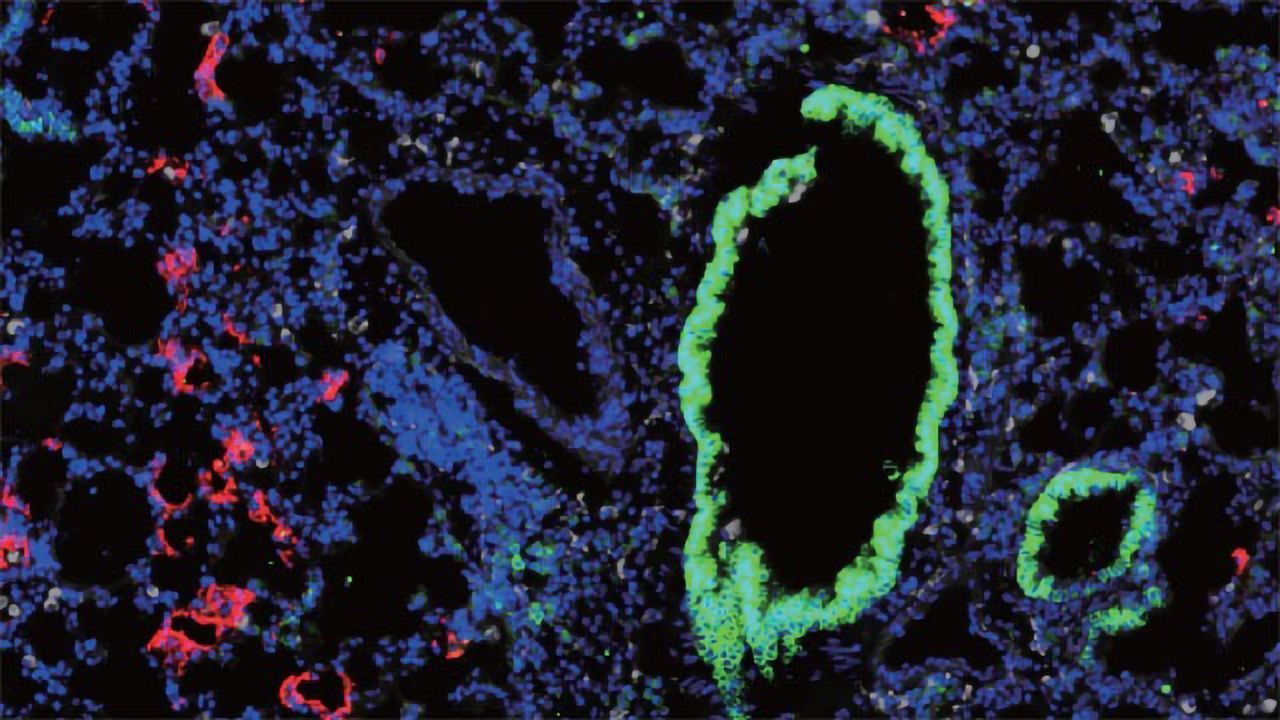 Two Is Better Than One for Novel COVID-19 Mouse Model