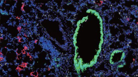 Two Is Better Than One for Novel COVID-19 Mouse Model