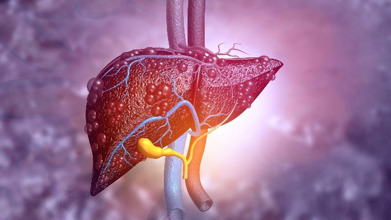 Could a Bioartificial Liver System Help To Treat Acute Liver Failure?
