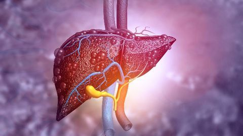 Could a Bioartificial Liver System Help To Treat Acute Liver Failure?