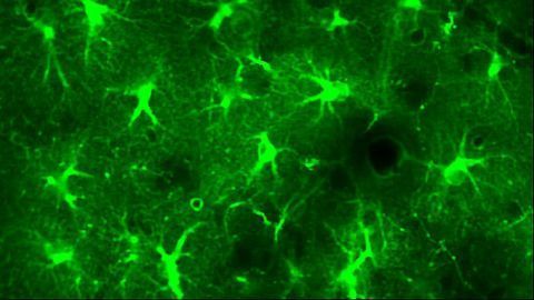 Astrocytes Play an Important Role in Maintaining Slow Wave Sleep