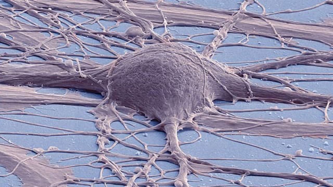 Cultured Human Neuron