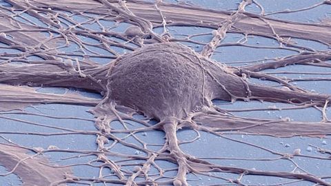 Cultured Human Neuron Cultured Human Neuron