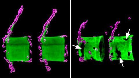 Modeling Osteoporosis in Fish Modeling Osteoporosis in Fish