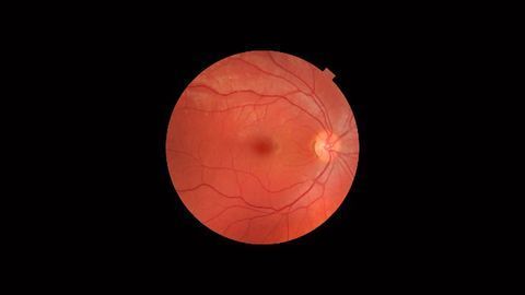 The Sci-Fi Eye: How Artificial Retinas Could Help Restore Sight