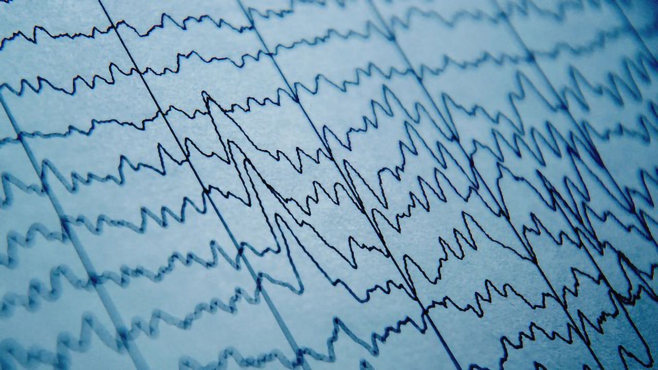 Brain Waves Can Predict Pain Sensitivity