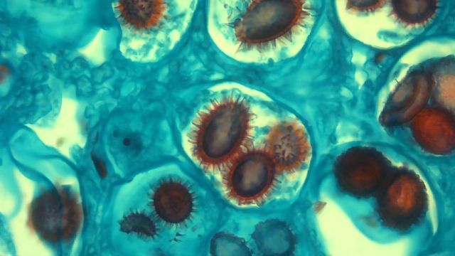 a-new-truffle-species-is-identified-four-decades-after-its-discovery-338403-640x360.jpg?cb=20200810