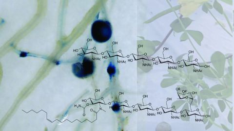 How Plants Differentiate Microbial Friends and Foes