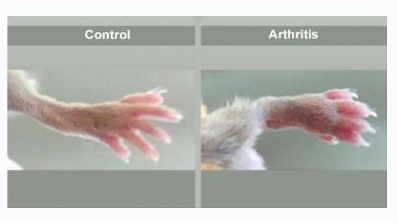 New Molecule Suppresses Inflammatory Process in Mice With Genetically-Induced Arthritis