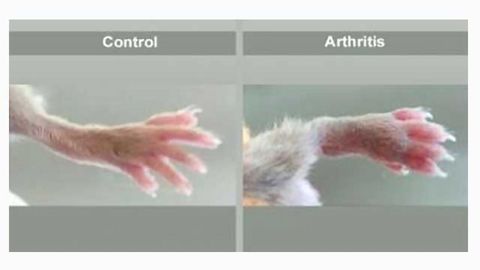 New Molecule Suppresses Inflammatory Process in Mice With Genetically-Induced Arthritis