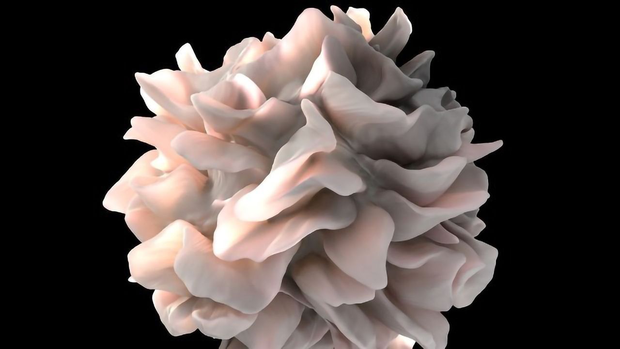 Immune System Deviations Revealed in Severe COVID-19 Cases