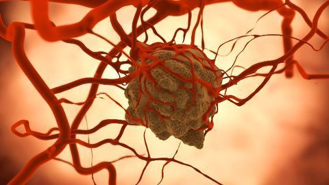 The Microbiome’s Role in Attacking Cancerous Tumors