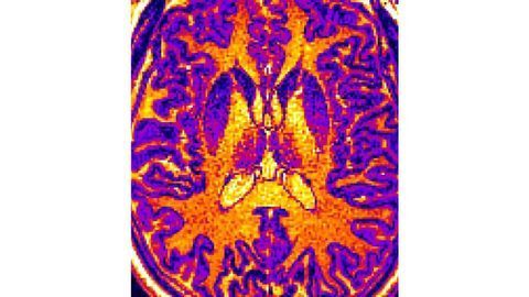 Can Machine Learning and Brain Imaging Create Better Diagnostics for Mental Illness?