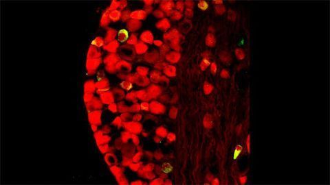 tdTomato Expression in Nodose Neurons tdTomato Expression in Nodose Neurons