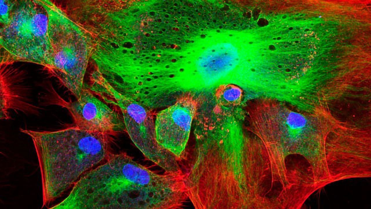 Caring for Your Confocal Microscope