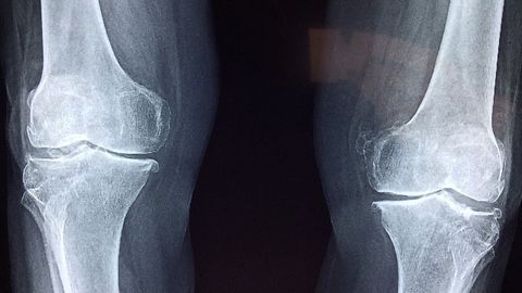 Researchers Find Method to Regrow Cartilage in the Joints