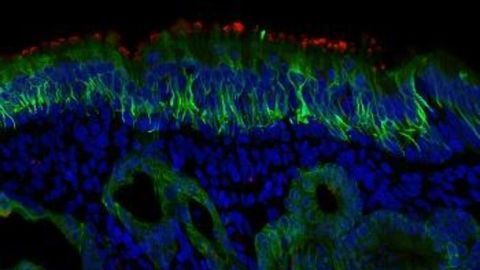 Study Adds to Evidence That Odor-Sensing Cells in the Nose Are the Key Entry Point for SARS CoV-2