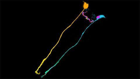 Nematode Worm Nerve Cells Fusing Together Nematode Worm Nerve Cells Fusing Together
