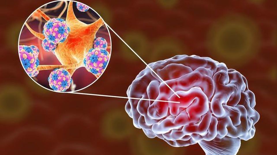 SARS-CoV-2 Can Infect Human Brain Organoids, Study Shows content piece image