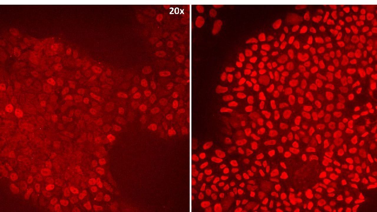 The Road To Scale: Challenges Facing the Implementation of Animal-Free Recombinant Proteins Into Stem Cell Supply Chains