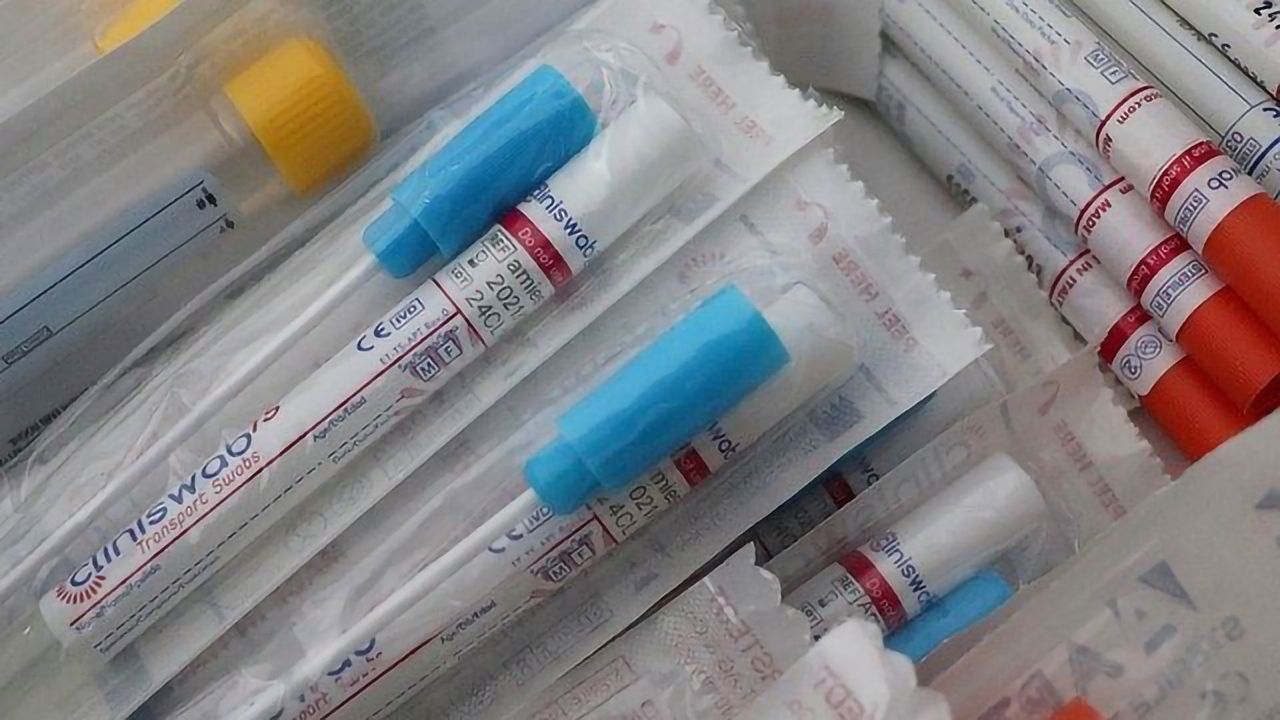 Self-Collected Saliva and Deep Nasal Swabs Are Equally Effective for Diagnosis of COVID-19