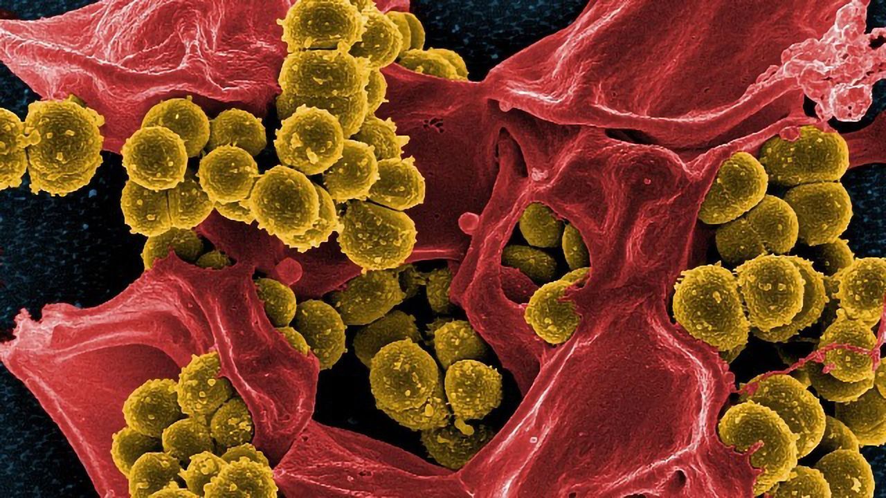 Certain Combinations of Gut Bacteria Worsen Symptoms of Multiple Sclerosis in Mice