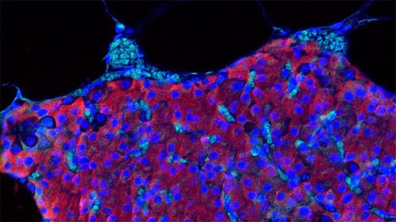 Transplanted Pancreatic Islet Cells