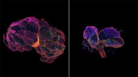 Modeling Infertility in Flies Modeling Infertility in Flies