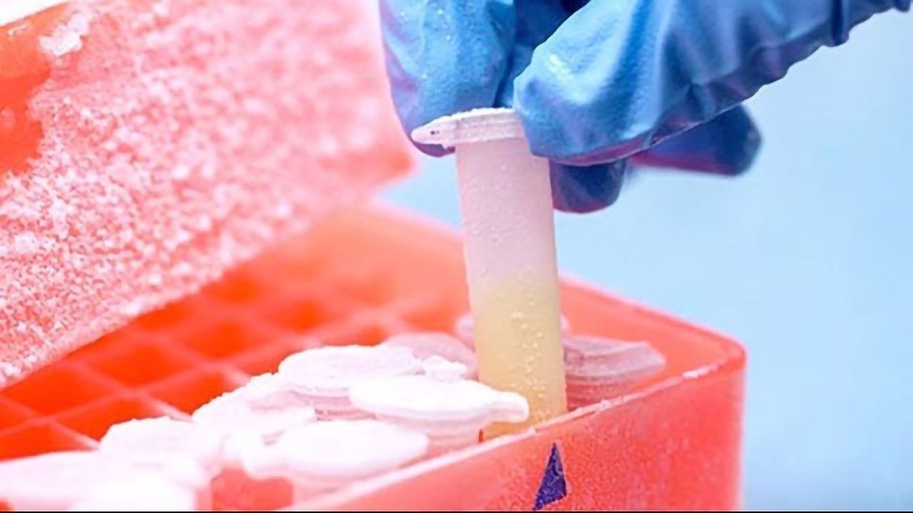 Optimized Freezing Solutions for Clinical Application of Cell Therapy Products