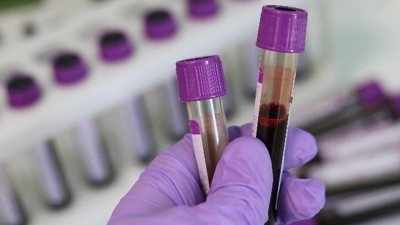 Virus in the Blood Can Predict Severe COVID-19