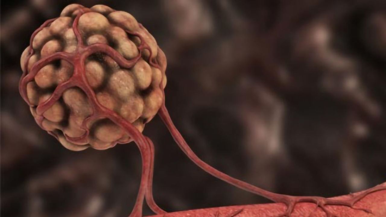 Non-Small Cell Lung Cancer: Attacking Tumors From the Inside
