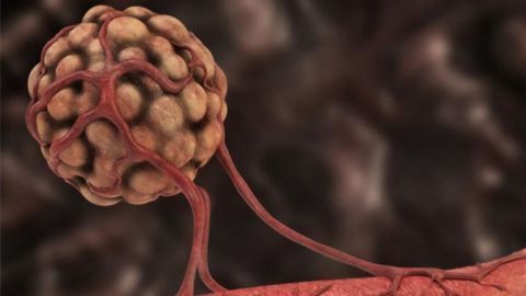 Non-Small Cell Lung Cancer: Attacking Tumors From the Inside