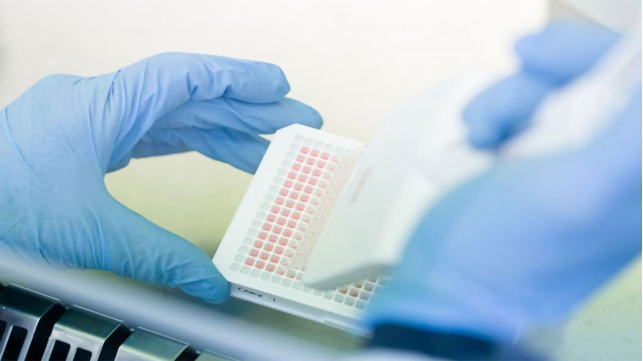How Advanced Bioinformatics Can Overcome Data Overwhelm in Biomarker Discovery for Patient Stratification