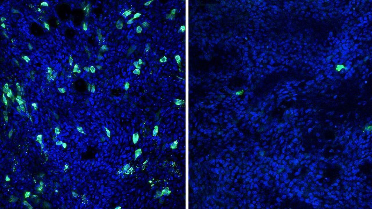 Common Cold an Unlikely Ally in Fighting Flu