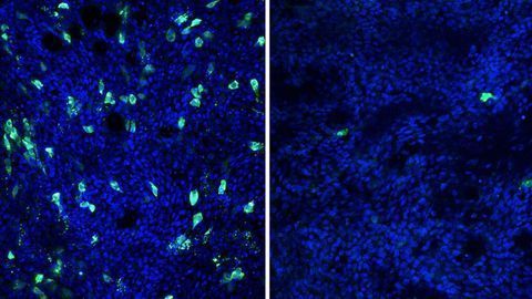 Common Cold an Unlikely Ally in Fighting Flu