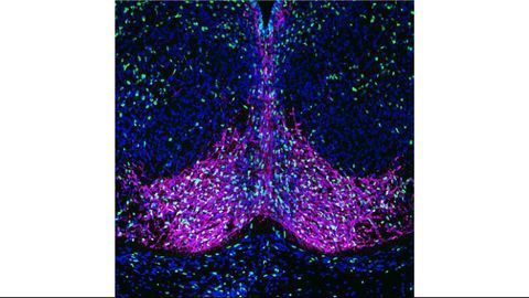 Offspring of Mice Fed Imbalanced Diets Appear "Programmed" for Obesity