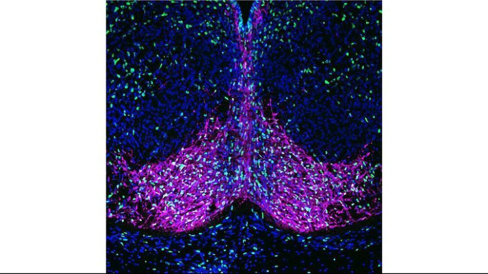 Offspring of Mice Fed Imbalanced Diets Appear "Programmed" for Obesity content piece image